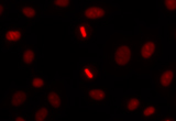 Propidium iodide staining of HeLa cells