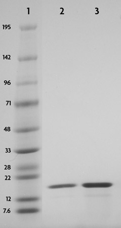SDS-PAGE gel of recombinant phosphorylated histones