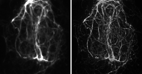 Confocal and STED microscopy images of cells stained with vimentin