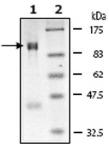 LSD1 Coomassie gel