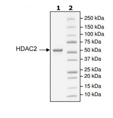 HDAC2 activity assay