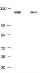 EGF Receptor phospho Tyr992 pAb tested by Western blot.