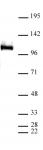 LSD1 antibody (pAb) tested by ChIP.