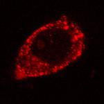 Rad52 pAb tested by immunofluorescence.