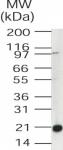 UBE2V1a pAb tested by Western blot.