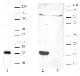 <b>Htz1 pAb tested by ChIP.</b><br>Chromatin immunoprecipitation performed on <i>S. cerevesiae chromatin</i> using 2 µl of Htz1 pAb. Real-time quantitative PCR was performed using primers corresponding to the Act1 gene open reading frame and the GAL1 gene TATA box.