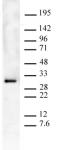 CID pAb tested by Western blot.