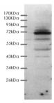 p63 antibody (pAb) tested by ChIP.