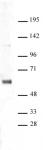 SNF5 antibody (pAb) tested by Western blot.