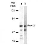 IRAK-2 pAb tested by Western blot.