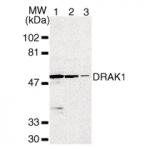 DRAK1 pAb tested by Western blot.