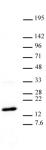 Histone H3 trimethyl Lys27 antibody (mAb) tested by Western blot.