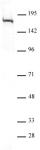 BLM antibody (pAb) tested by Western blot.