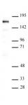 SIP1 antibody (mAb) tested by Western blot.