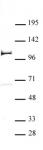PHF20 antibody (pAb) tested by Western blot.
