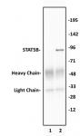 STAT5B antibody (pAb) tested by Western blot.