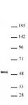 DP1 antibody (pAb) tested by Western blot.