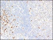 PIM2 antibody (mAb) tested by Western blot.