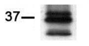 PIM2 antibody (mAb) tested by immunohistochemistry.