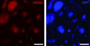 LIN28A antibody (pAb) tested by Western blot.