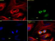 ASPM / MCPH5 antibody (pAb) tested by immunofluorescence.