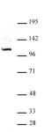 GLI1 antibody (pAb) tested by Western blot.
