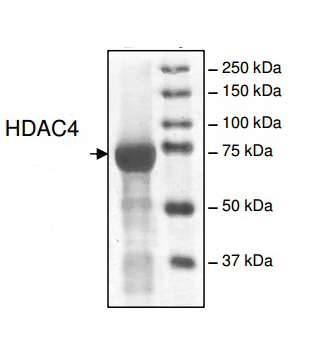 HDAC4 protein Coomassie gel