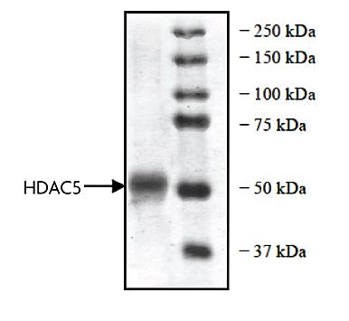 HDAC5 protein Coomassie gel
