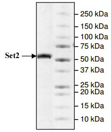 SETD2 (1418-1714) protein Coomassie gel