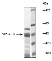 SUV39H2 protein Coomassie gel
