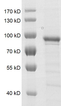 PRMT7 Coomassie gel