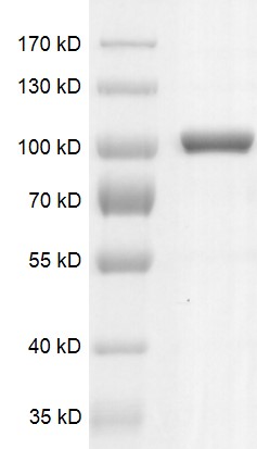DNMT3A protein Coomassie gel