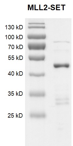 Recombinant KMT2D (MLL2)-SET protein Coomassie gel.