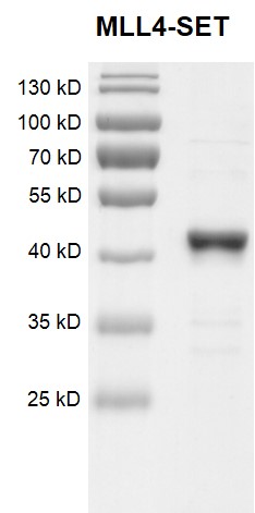 Recombinant KMT2B (MLL4)-SET Coomassie gel