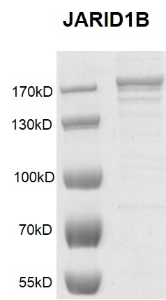 JARID1B / KDM5B Coomassie gel