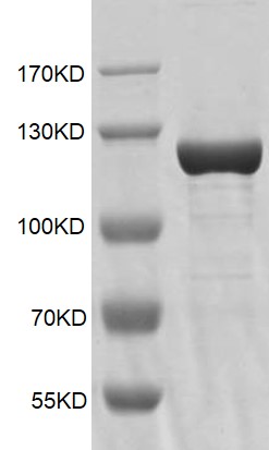 Recombinant KDM1B / LSD2 Coomassie gel