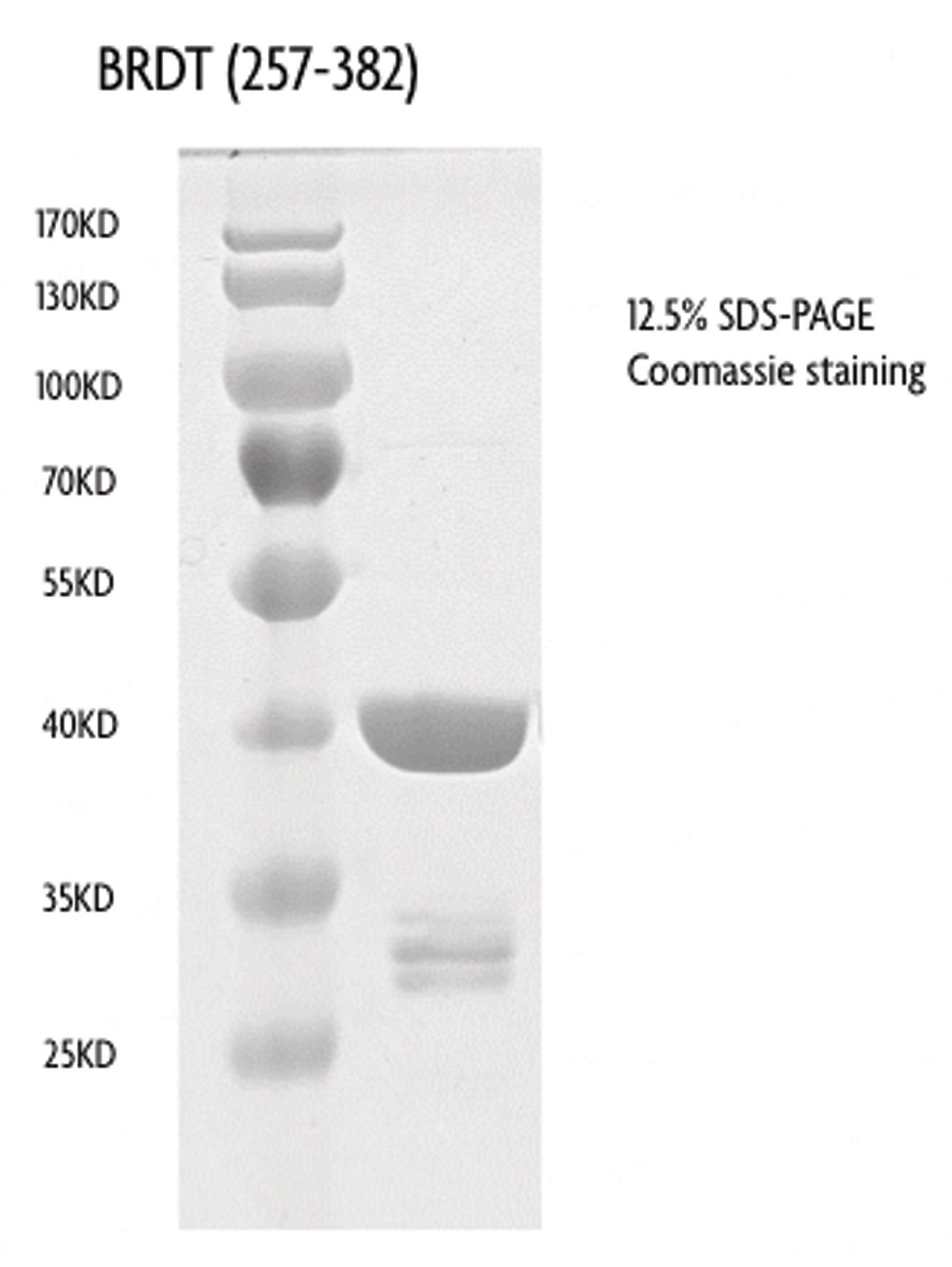 BRDT (257-382), GST-Tag protein gel.