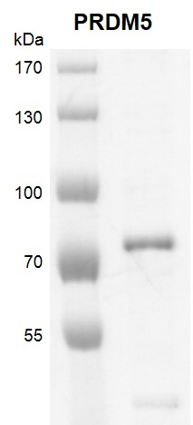 PRDM5 protein Coomassie gel