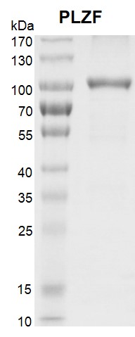 <b>Recombinant PLZF protein SDS-PAGE gel.</b>