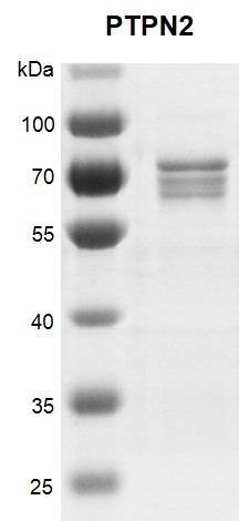 Recombinant PTPN2 protein gel.