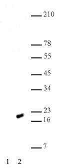 Histone H2AK5ac antibody (pAb) tested by Western blot.