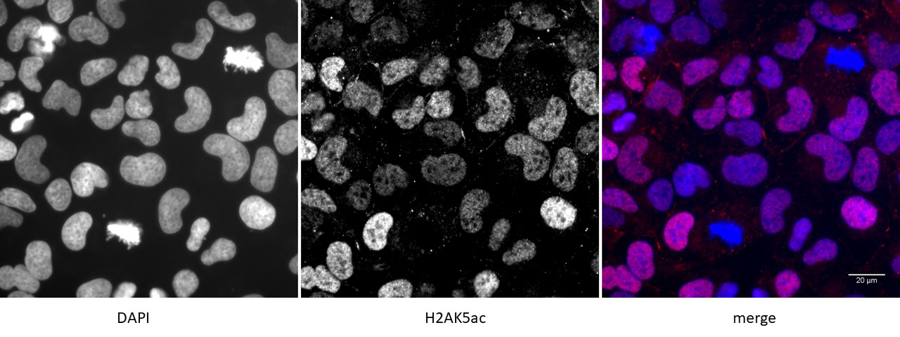 Histone H2AK5ac antibody (pAb) tested by immunofluorescence.