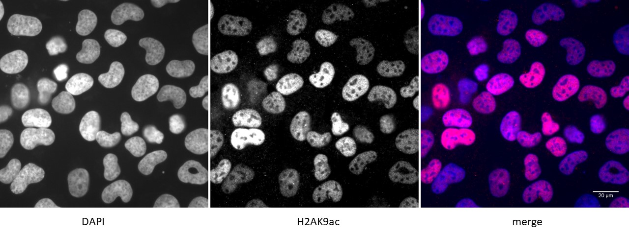 Histone H2AK9ac antibody (pAb) tested by immunofluorescence.