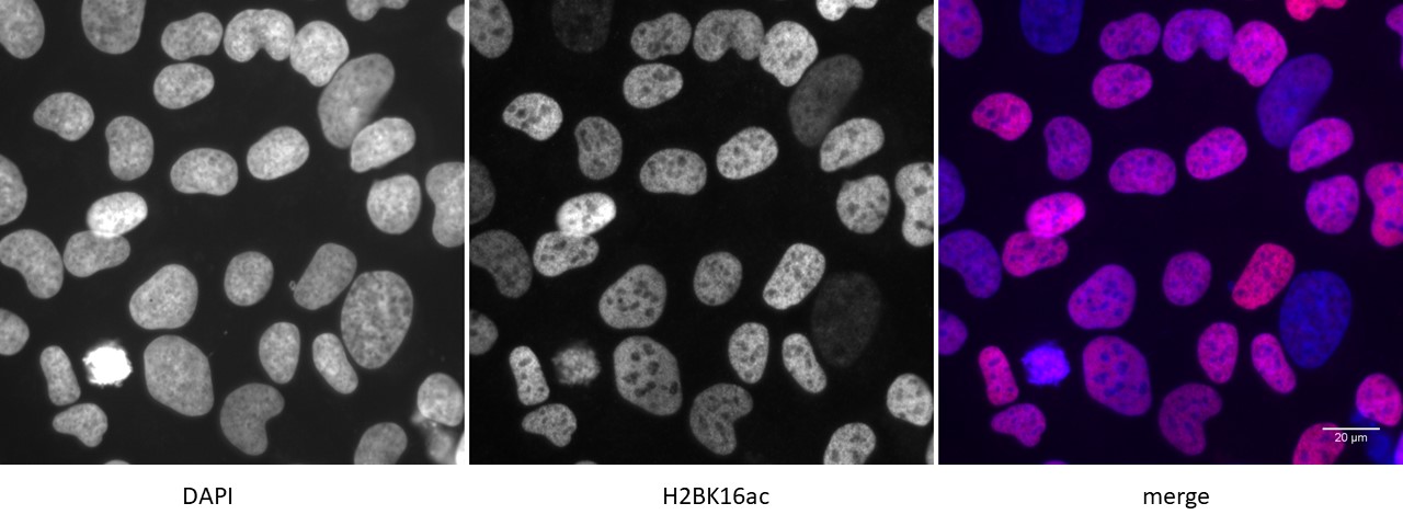 Histone H2BK16ac antibody (pAb) tested by immunofluorescence.