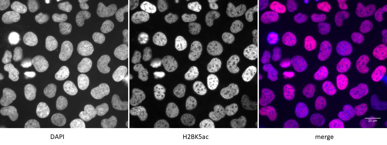 Histone H2BK5ac antibody (pAb) tested by immunofluorescence.