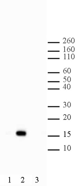 Histone H2BK5ac antibody (pAb) tested by Western blot.