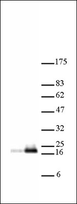 Histone H3K18ac antibody (pAb) tested by Western blot.