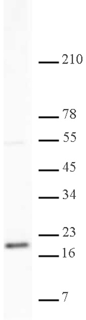 Histone H3K79me2 antibody (pAb) tested by Western blot.