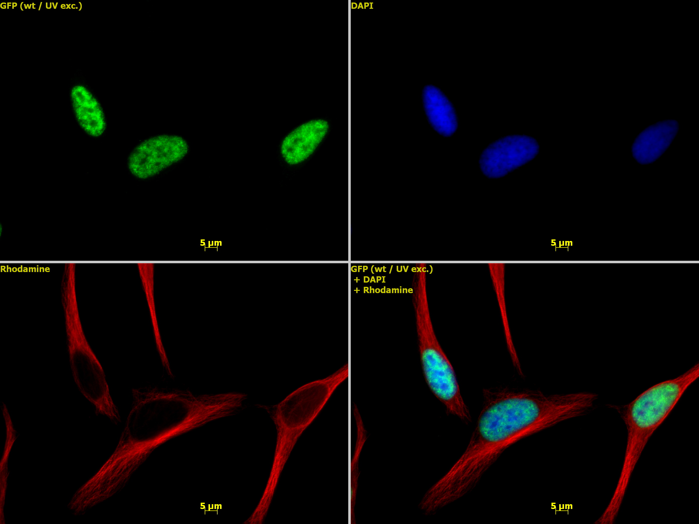 Histone H3K4me3 antibody (pAb) tested by immunofluorescence.
