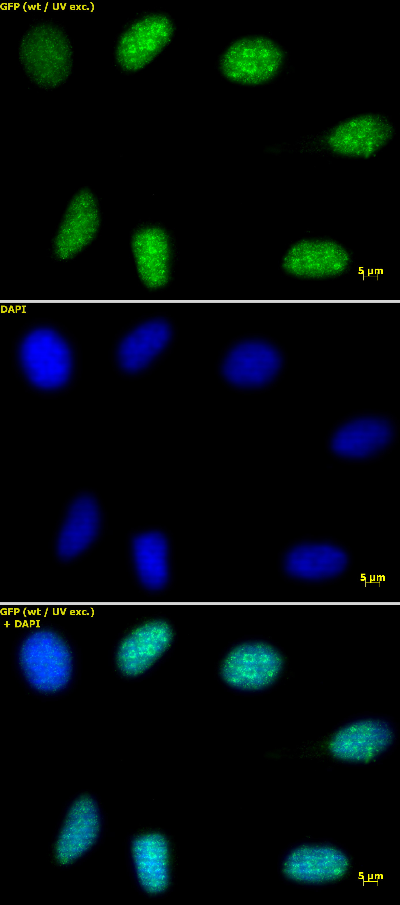 Histone H3K9me3 antibody (pAb) tested by immunofluorescence.